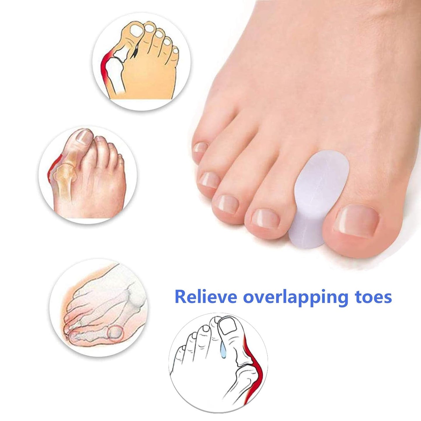 Soft Toe Spreader