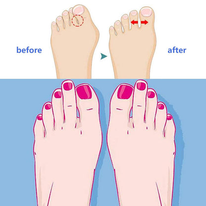 Soft Toe Spreader